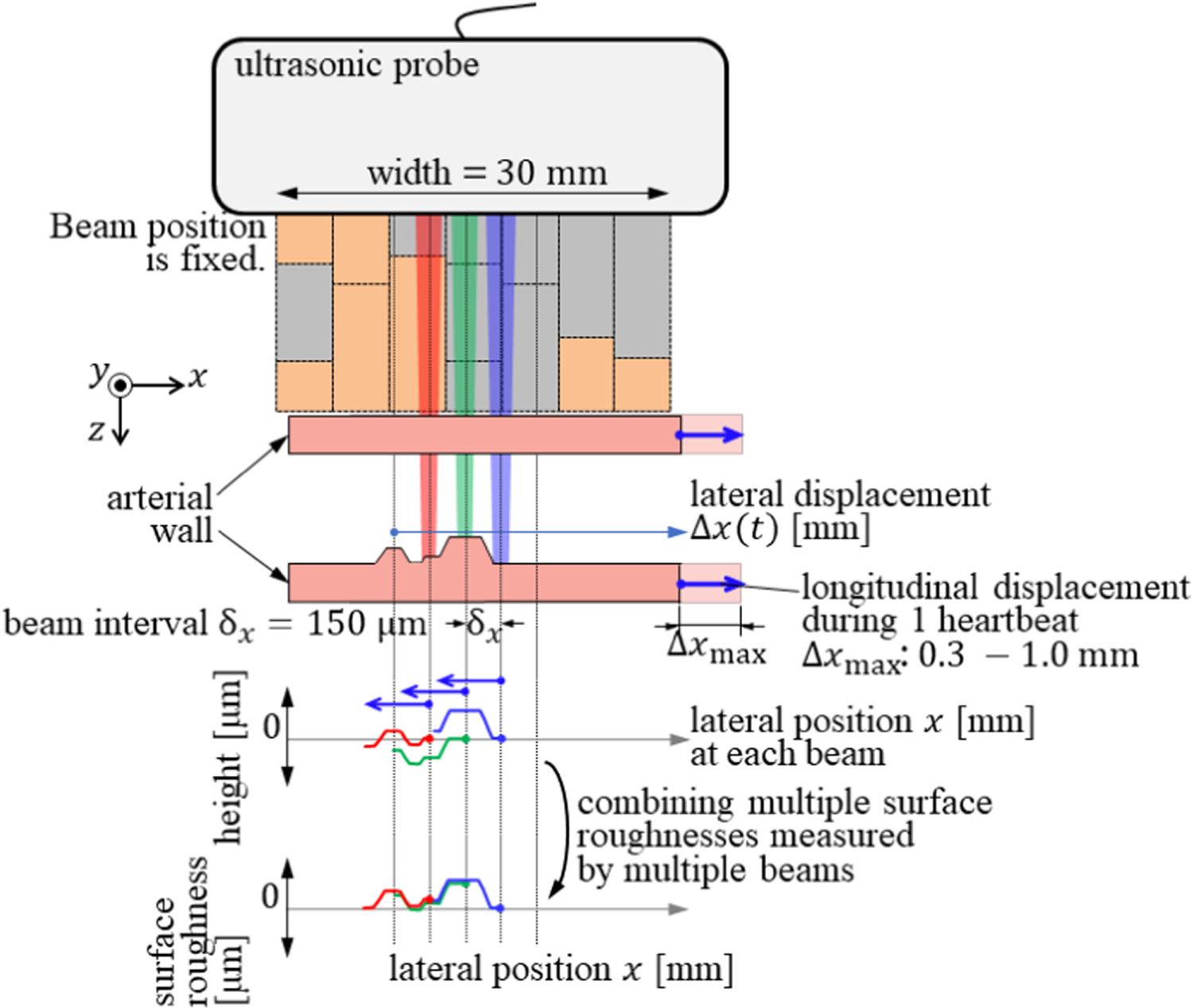 Ultrasonic measurement of thickness of carotid arterial wall using its ...