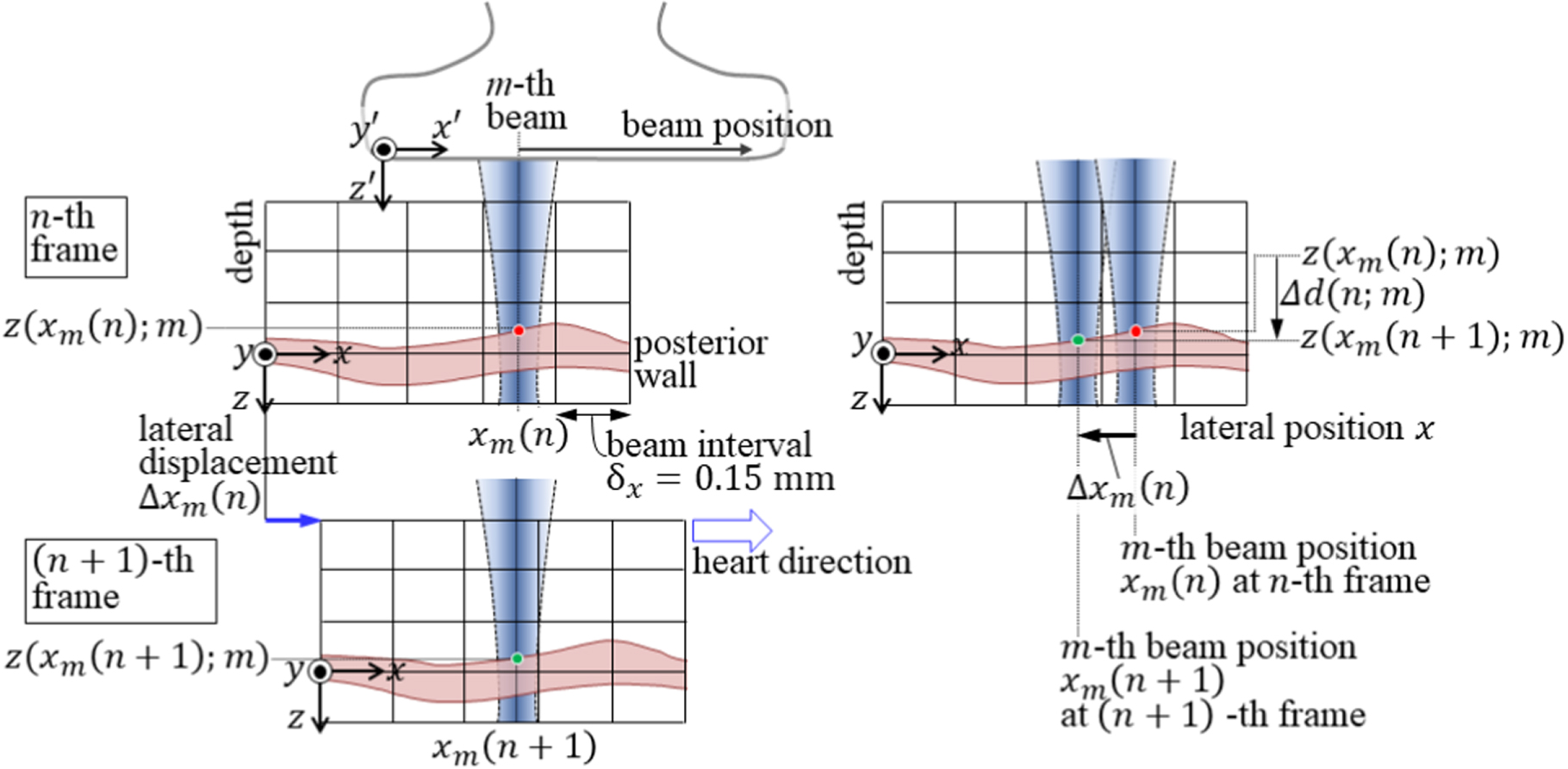 Ultrasonic measurement of thickness of carotid arterial wall using its ...