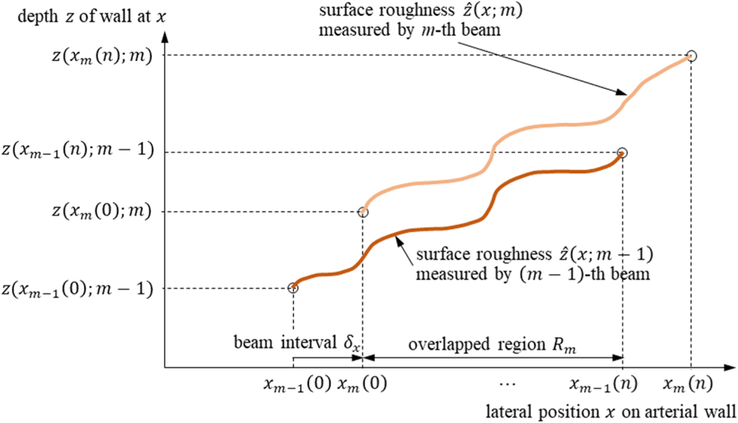 Ultrasonic measurement of thickness of carotid arterial wall using its ...