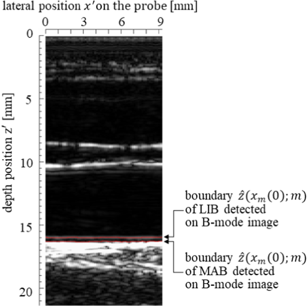 Ultrasonic measurement of thickness of carotid arterial wall using its ...