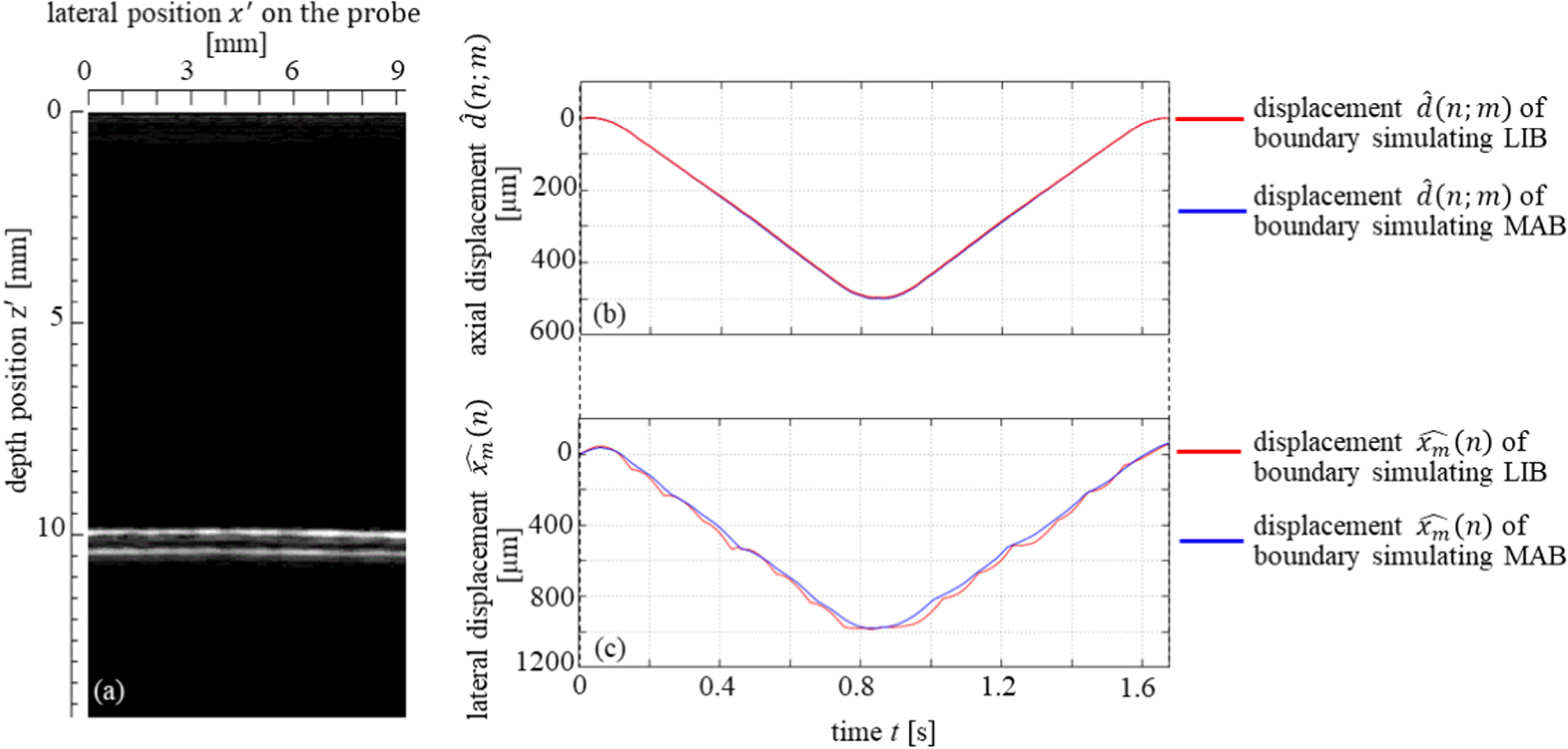 Ultrasonic measurement of thickness of carotid arterial wall using its ...
