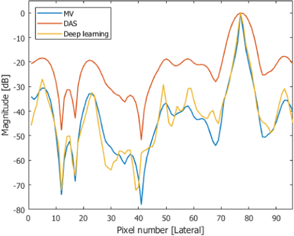Beamspace-domain learning of minimum variance beamformer with fully ...