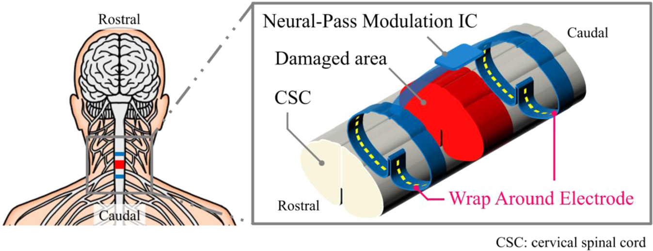 Neural Wraps Fabrication and evaluation of Wrap Around Neural-Pass to record and ...