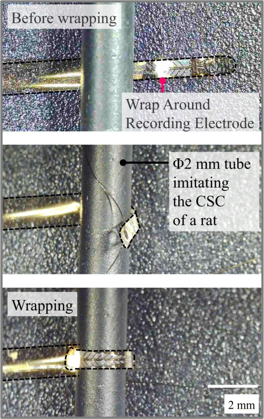 Neural Wraps Fabrication and evaluation of Wrap Around Neural-Pass to record and ...