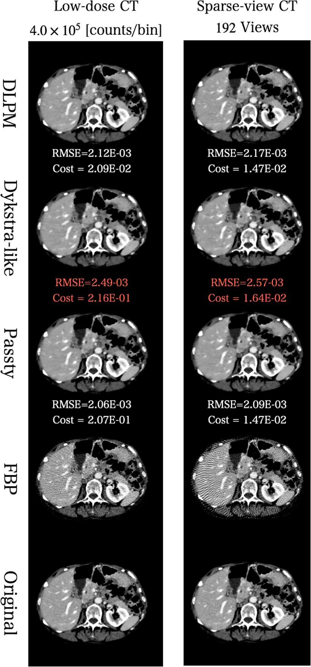 Accelerated iterative image reconstruction in computed tomography using ...