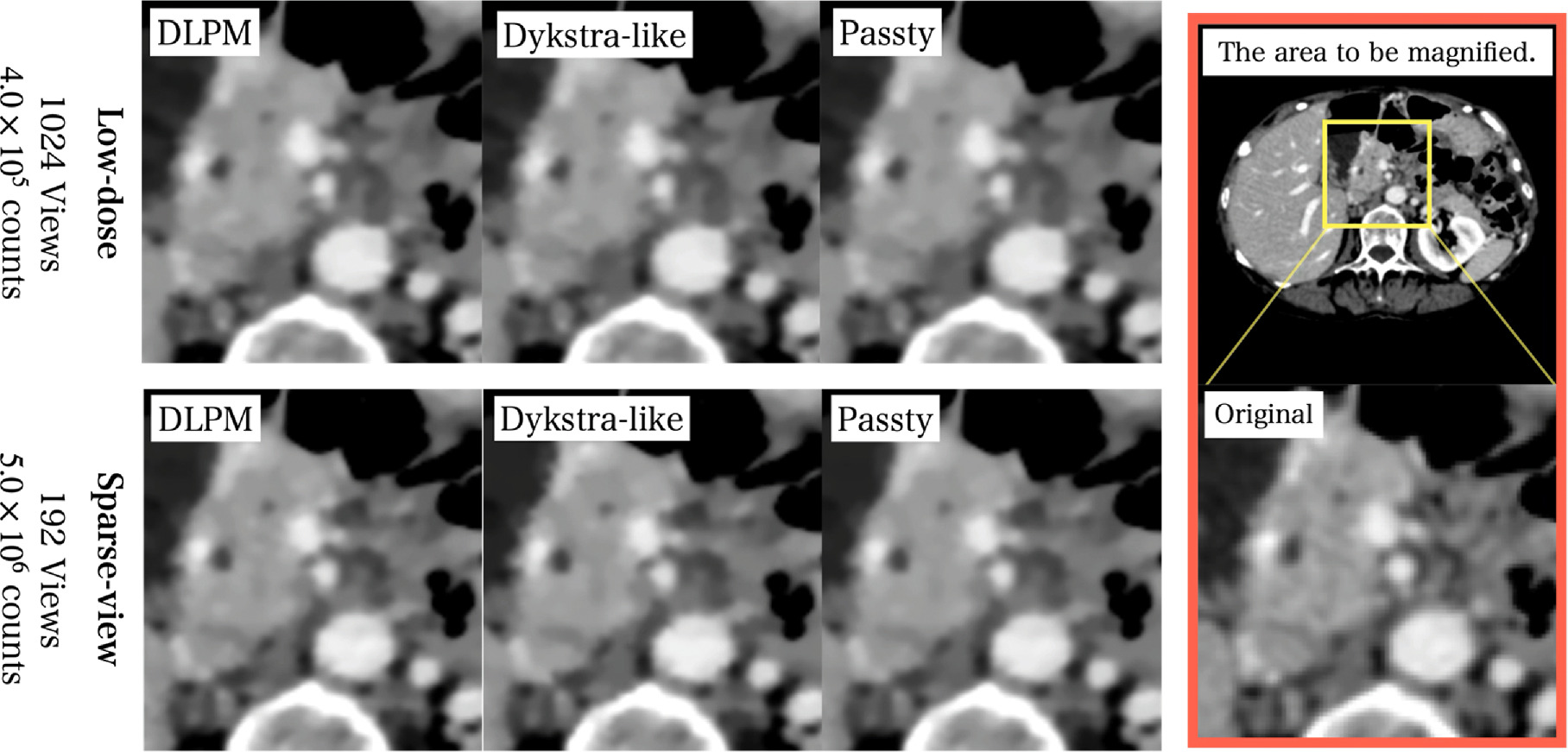 Accelerated iterative image reconstruction in computed tomography using ...