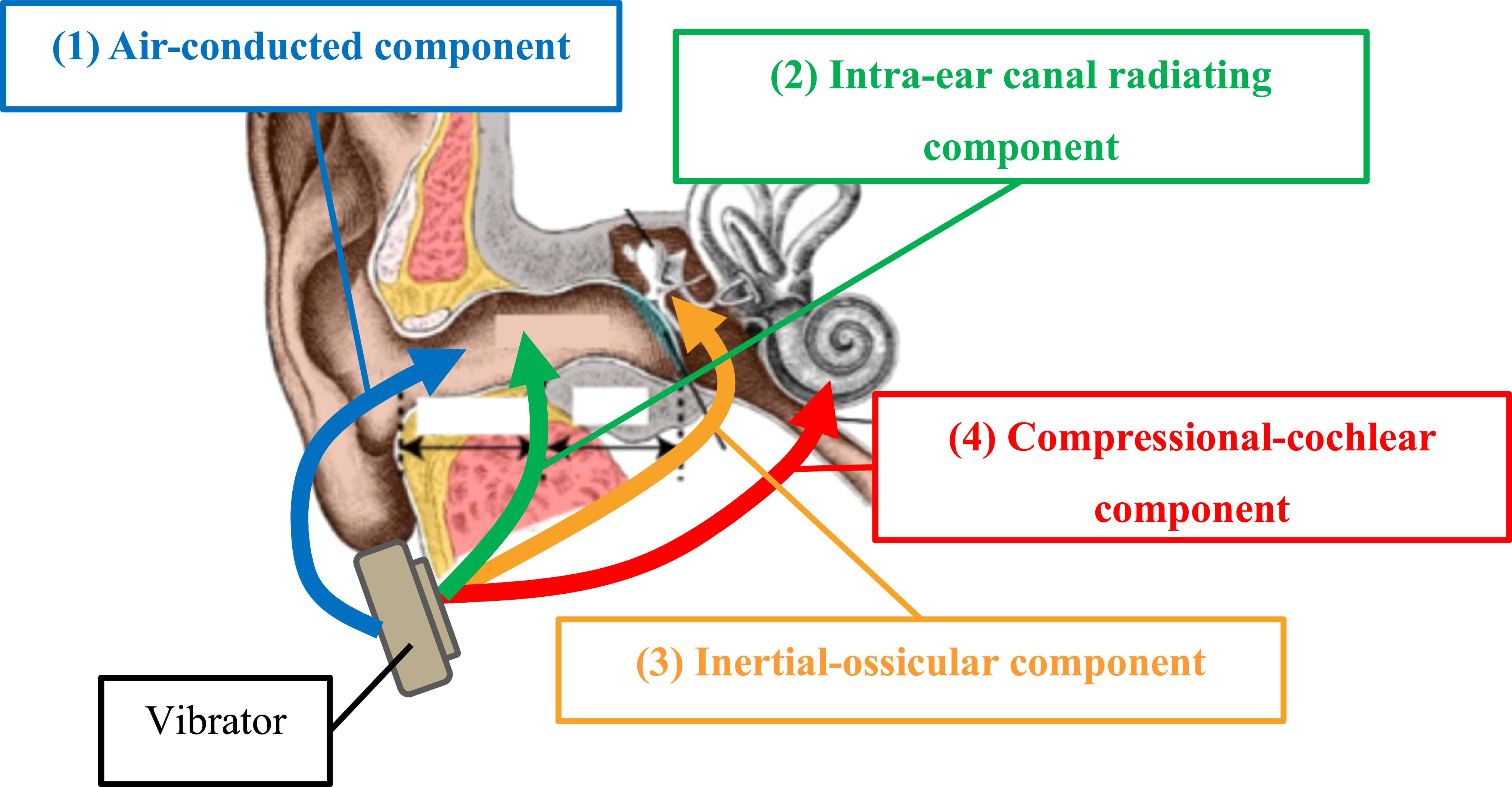 Ear Vertical Conduction Effects of characteristics of noise on the perception and propagation ...