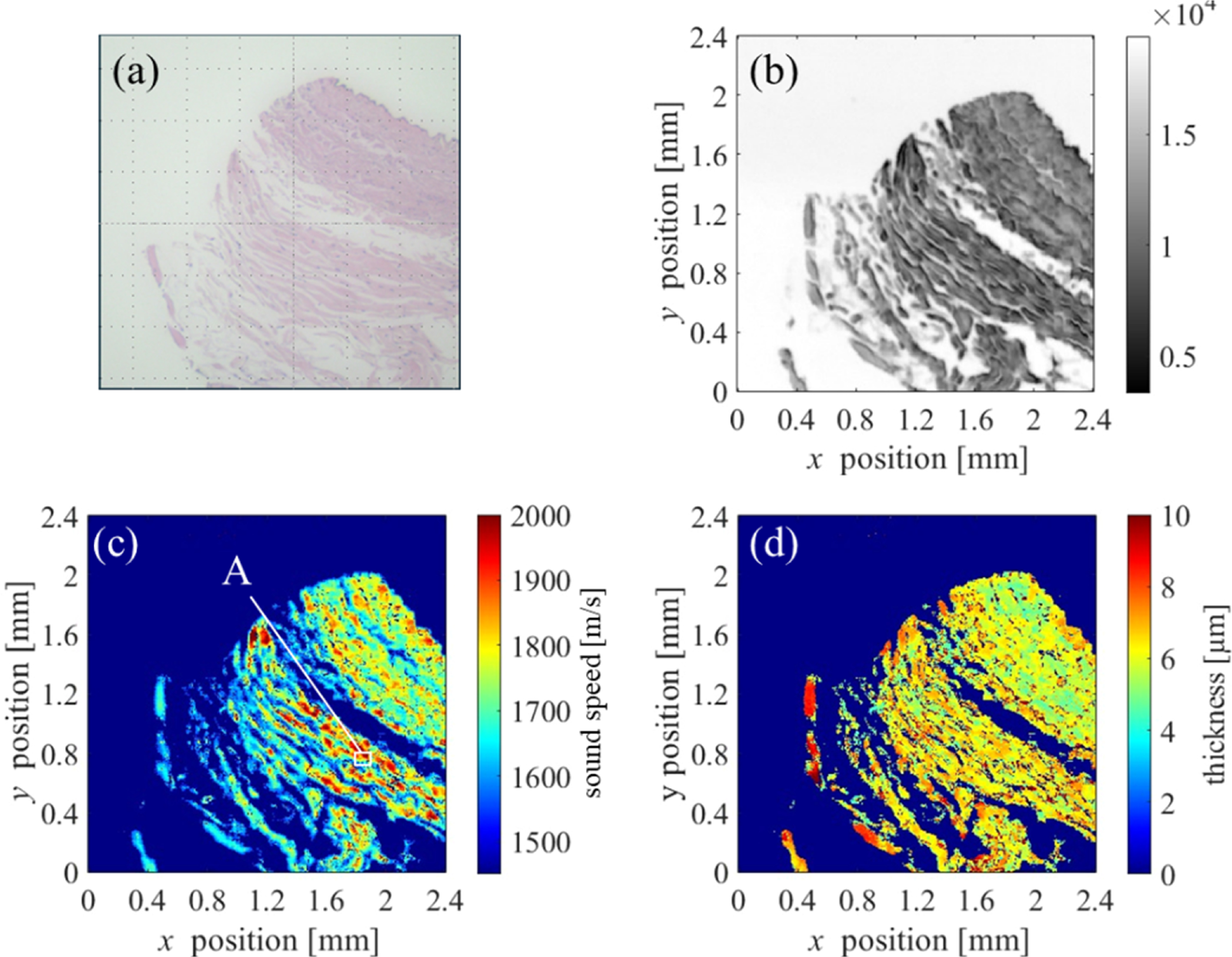 Measurement method for sound speed and attenuation of blood vessel ...