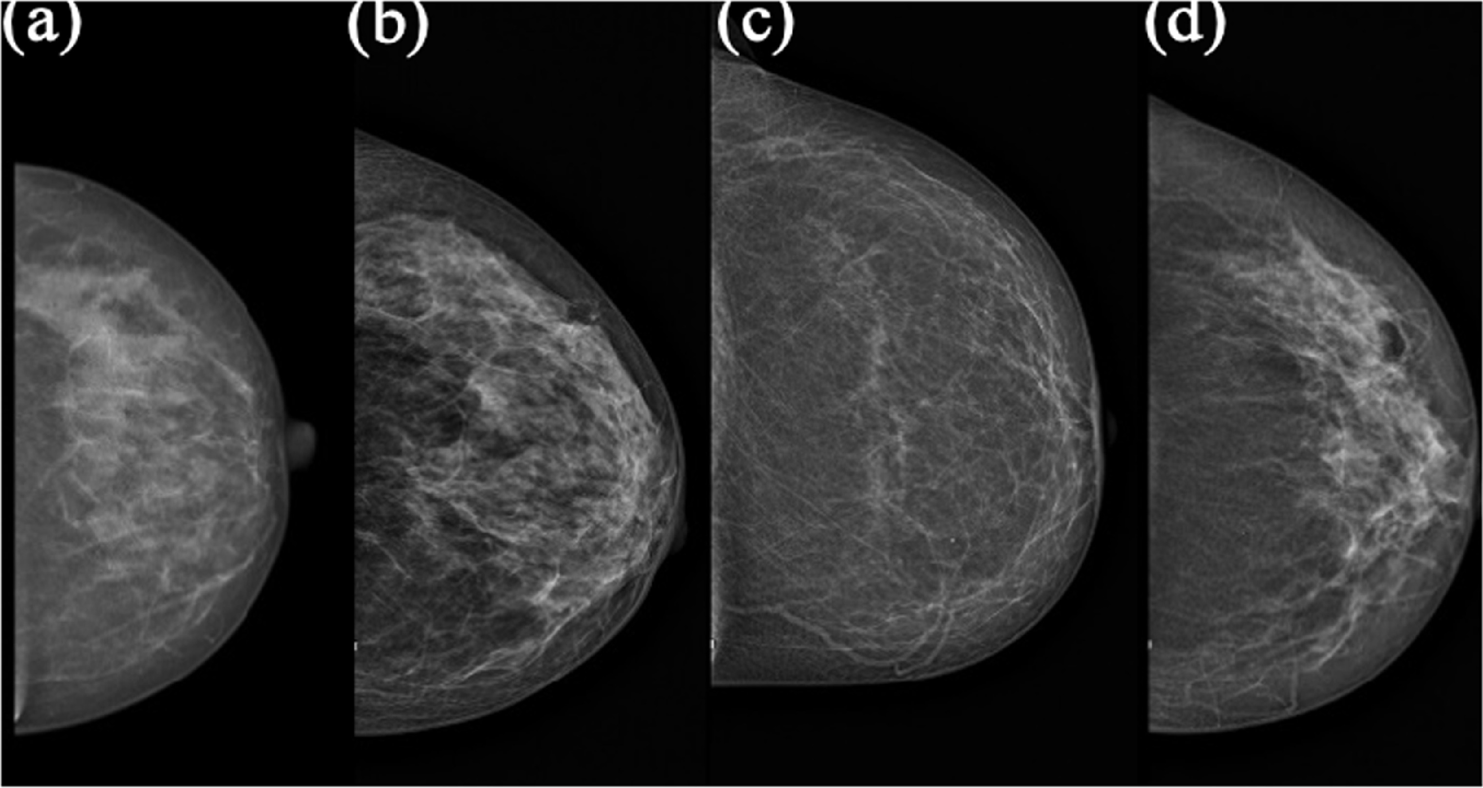 An evaluation of machine learning models for breast cancer detection on ...
