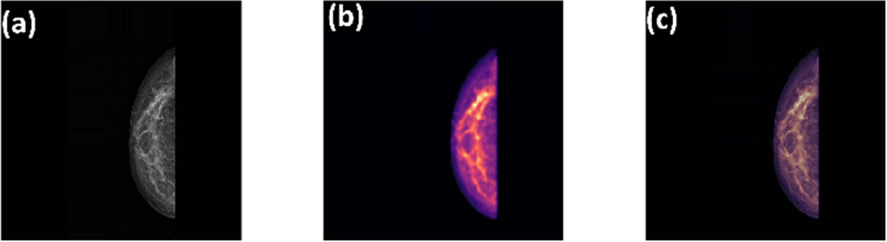 An evaluation of machine learning models for breast cancer detection on ...