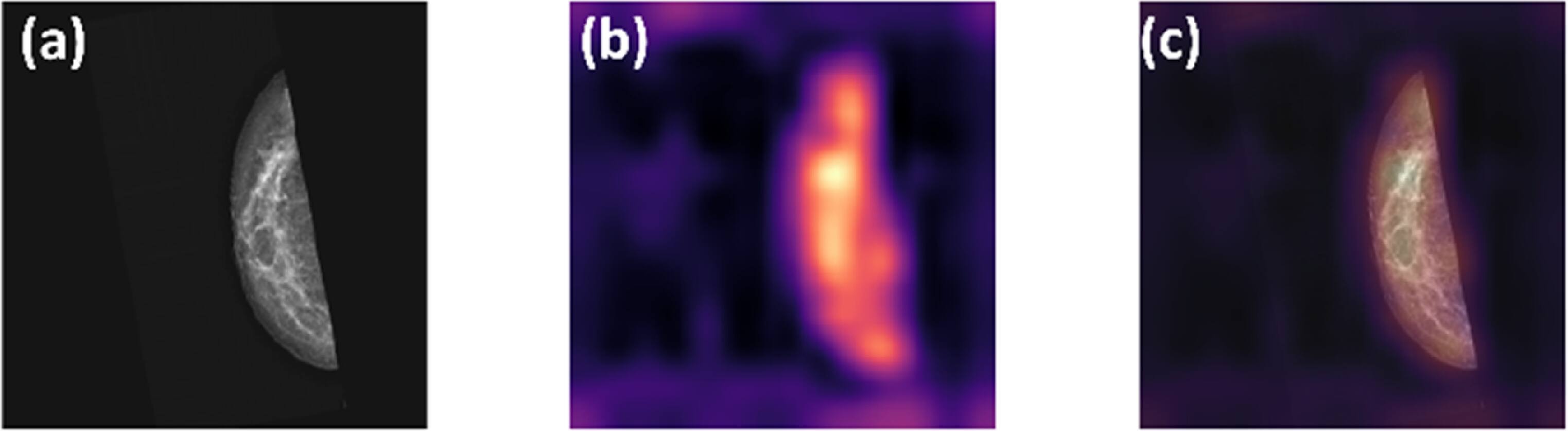 An evaluation of machine learning models for breast cancer detection on ...