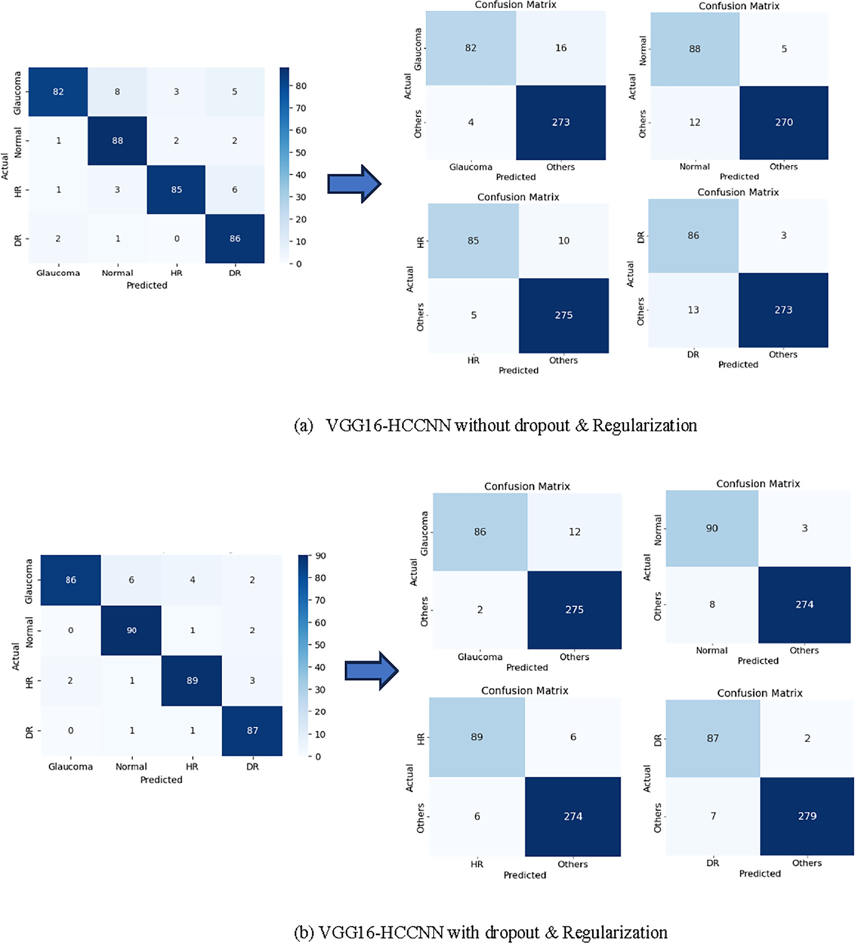 A multiclass deep learning framework for retinal disease detection ...