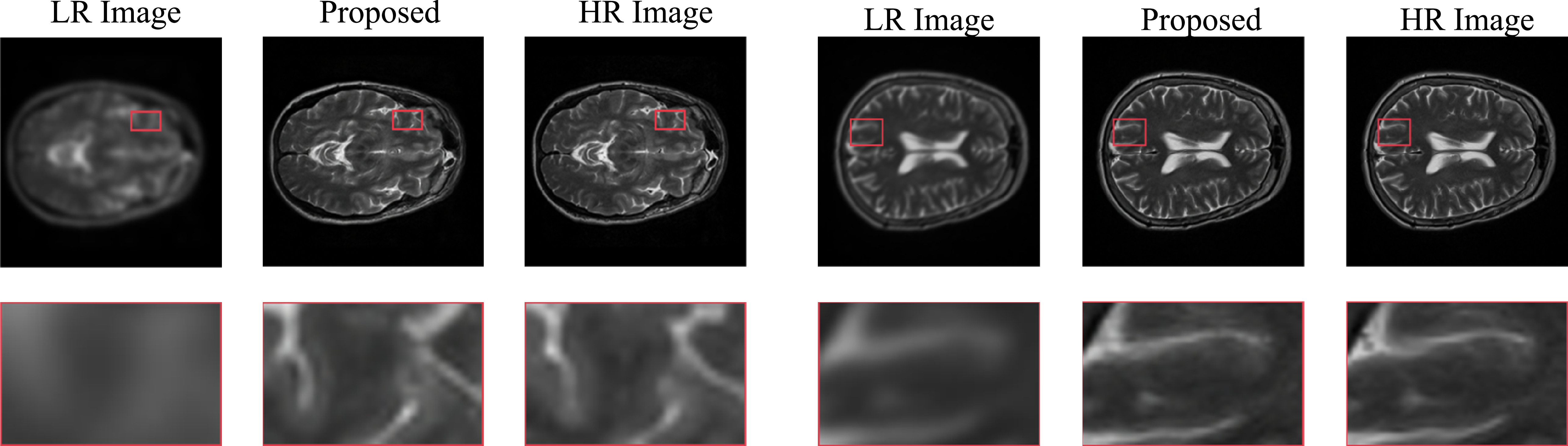 Dual-branch diffusion model with enhanced mamba for MRI blind super ...