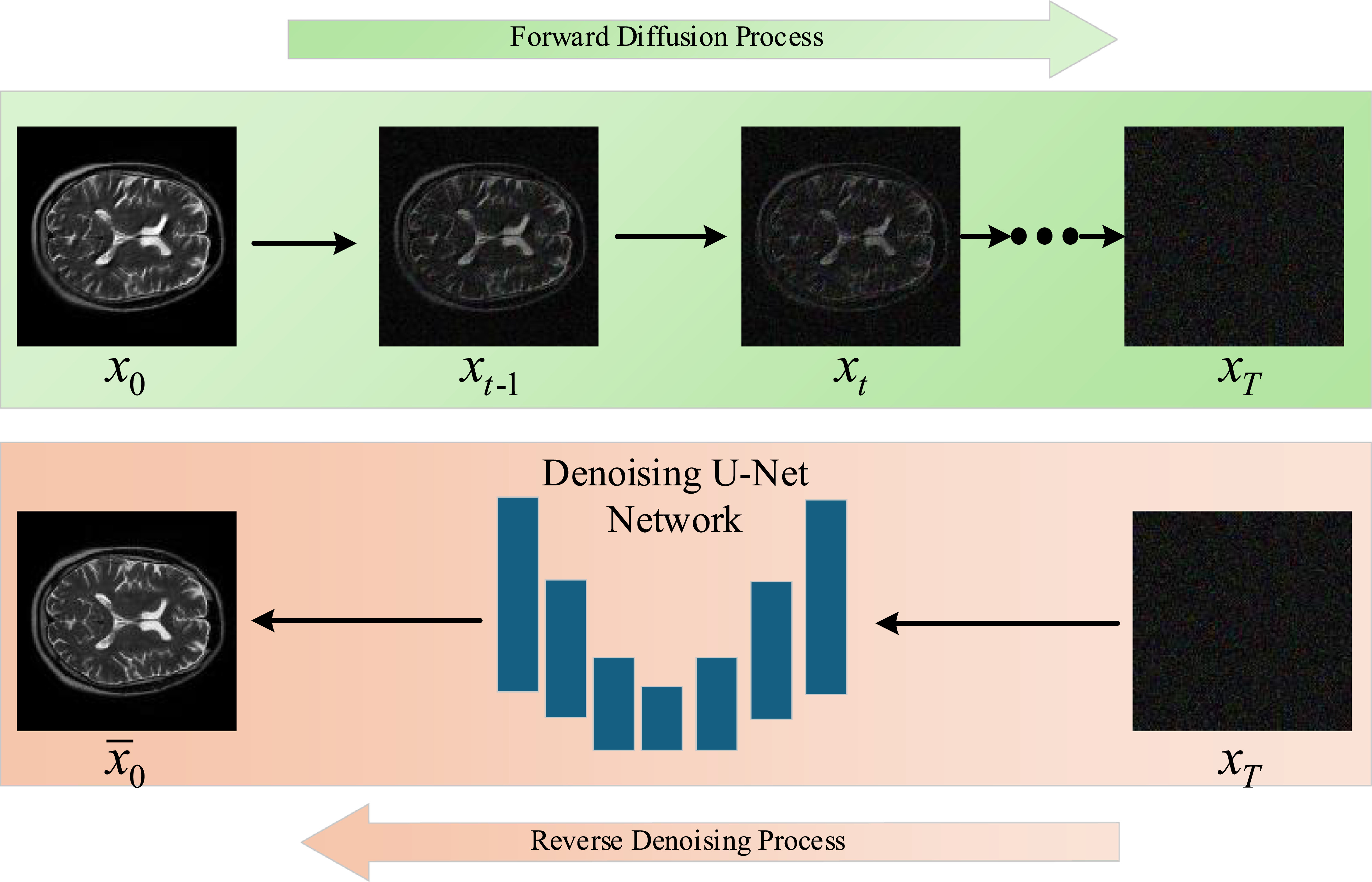 Dual-branch diffusion model with enhanced mamba for MRI blind super ...