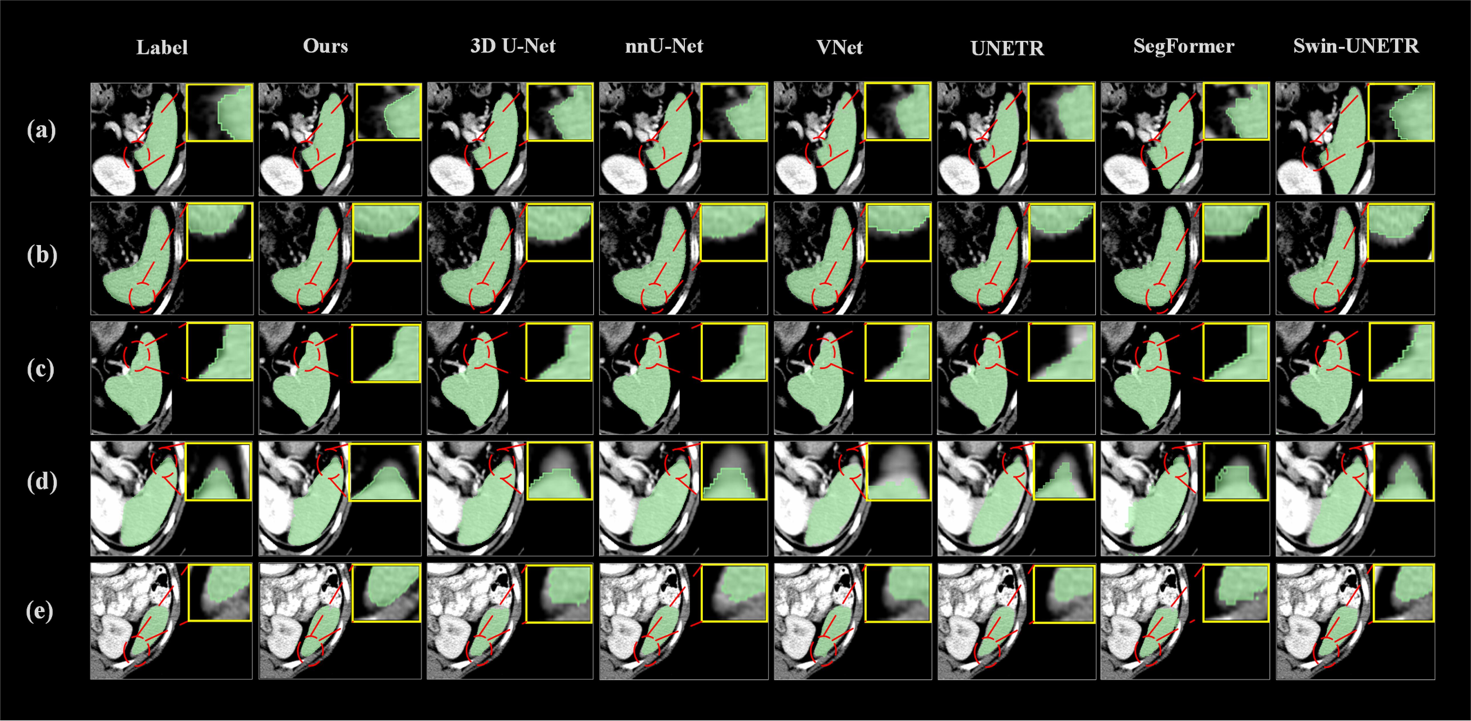 Three-branch dynamic selection network for 3d medical image ...