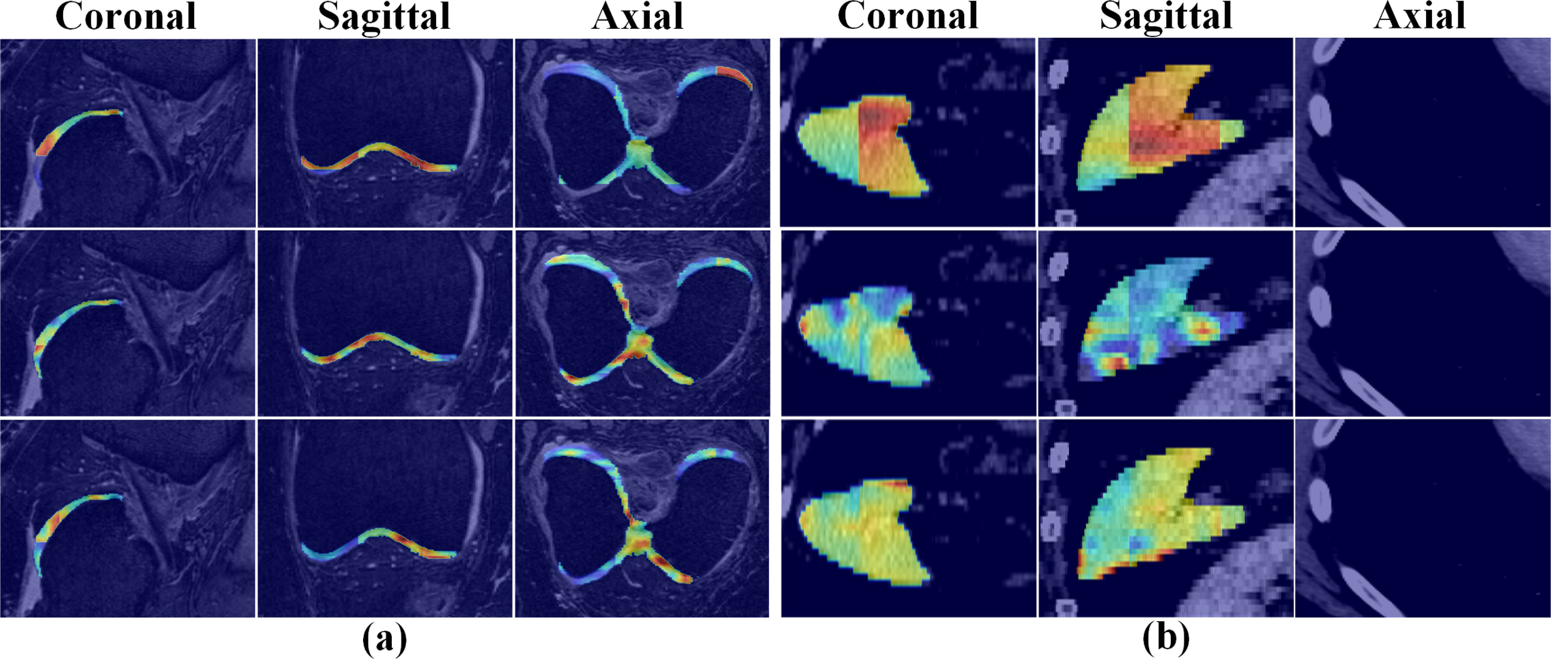 Three-branch dynamic selection network for 3d medical image ...
