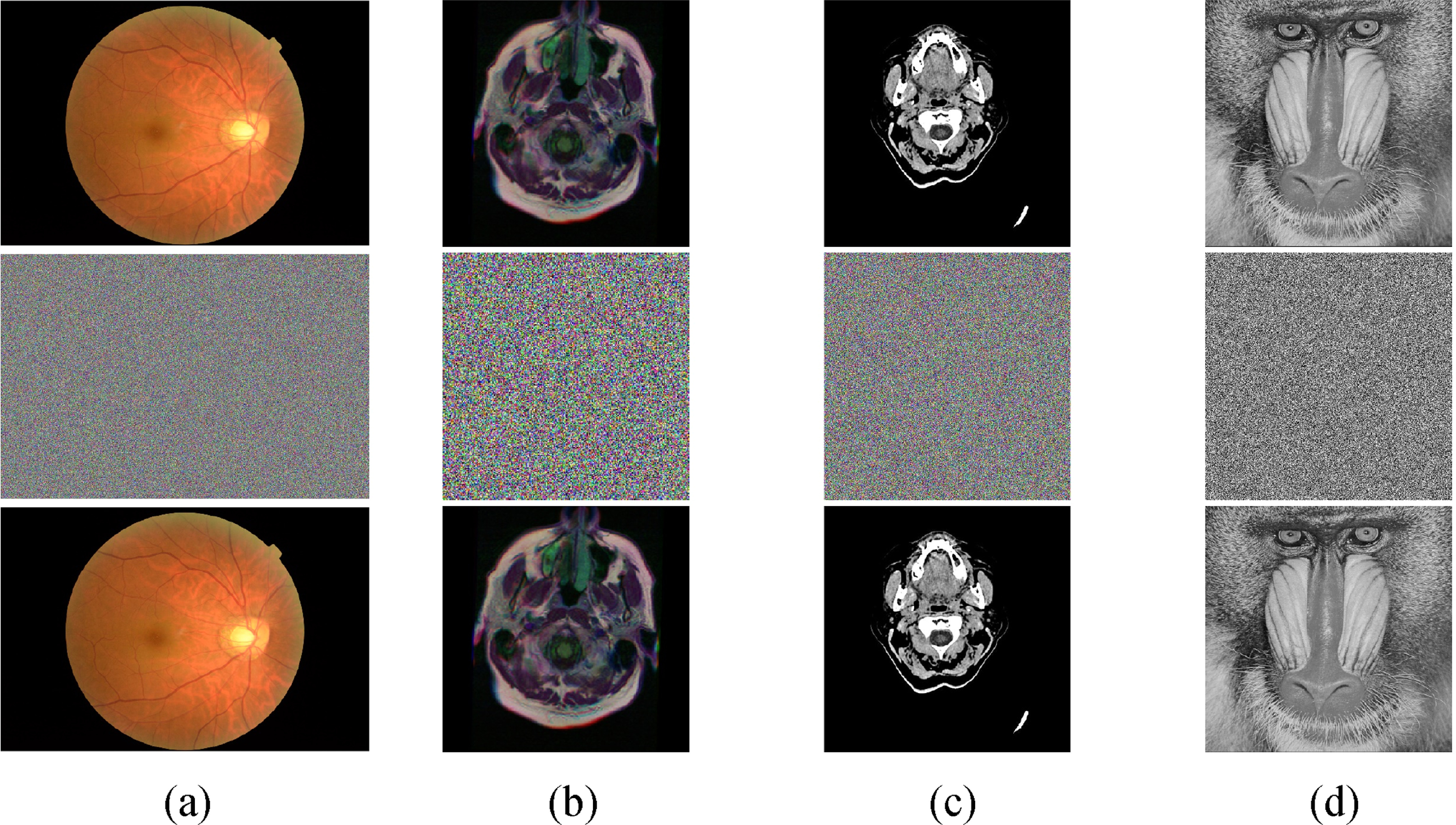Medical image encryption algorithm based on a novel 4D chaotic system ...