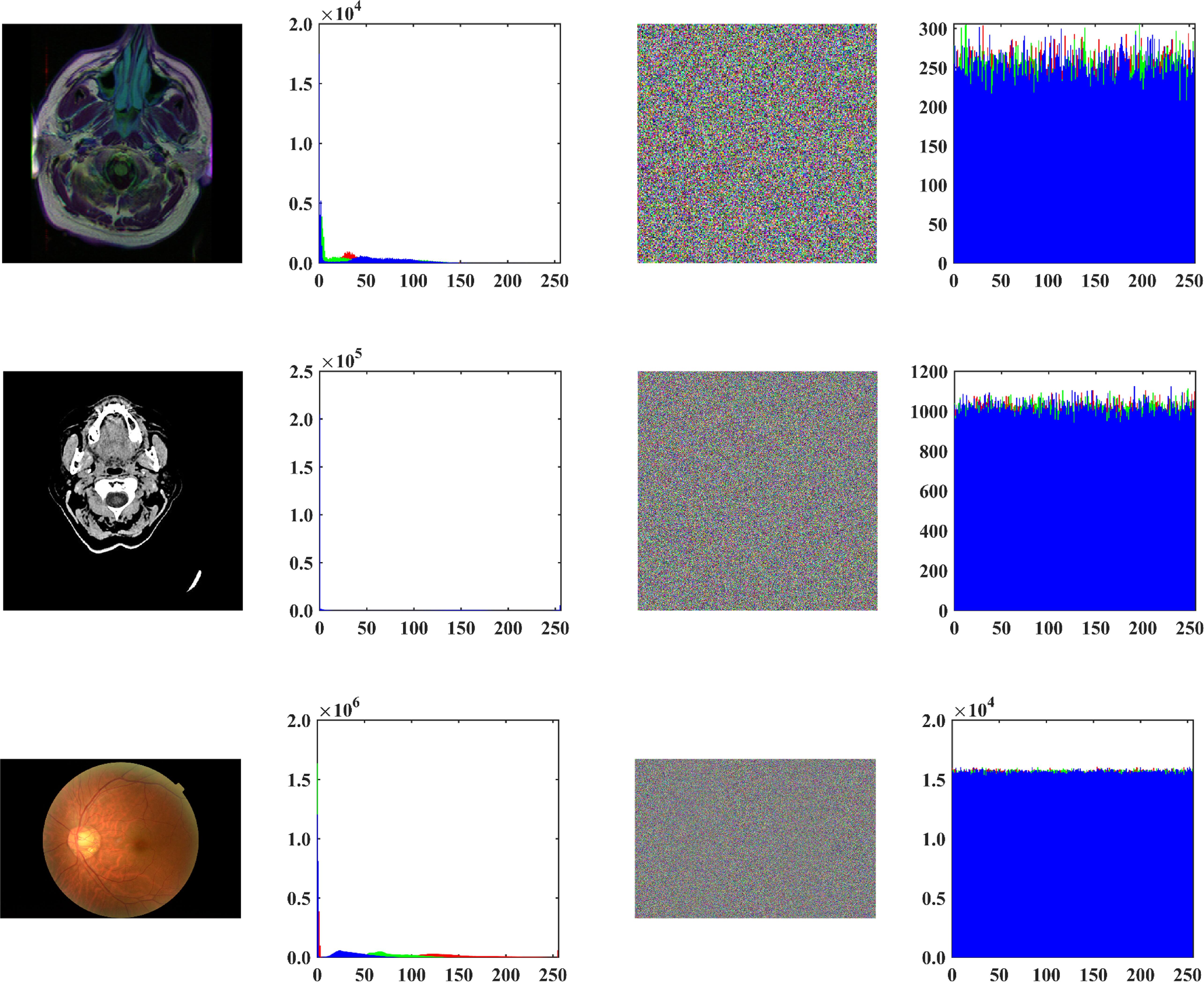 Medical image encryption algorithm based on a novel 4D chaotic system ...