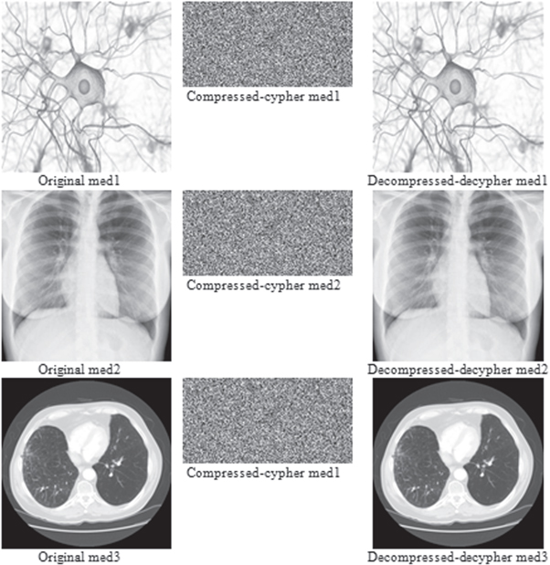 Autapse A memristive autapse-synapse neural network: application to image ...