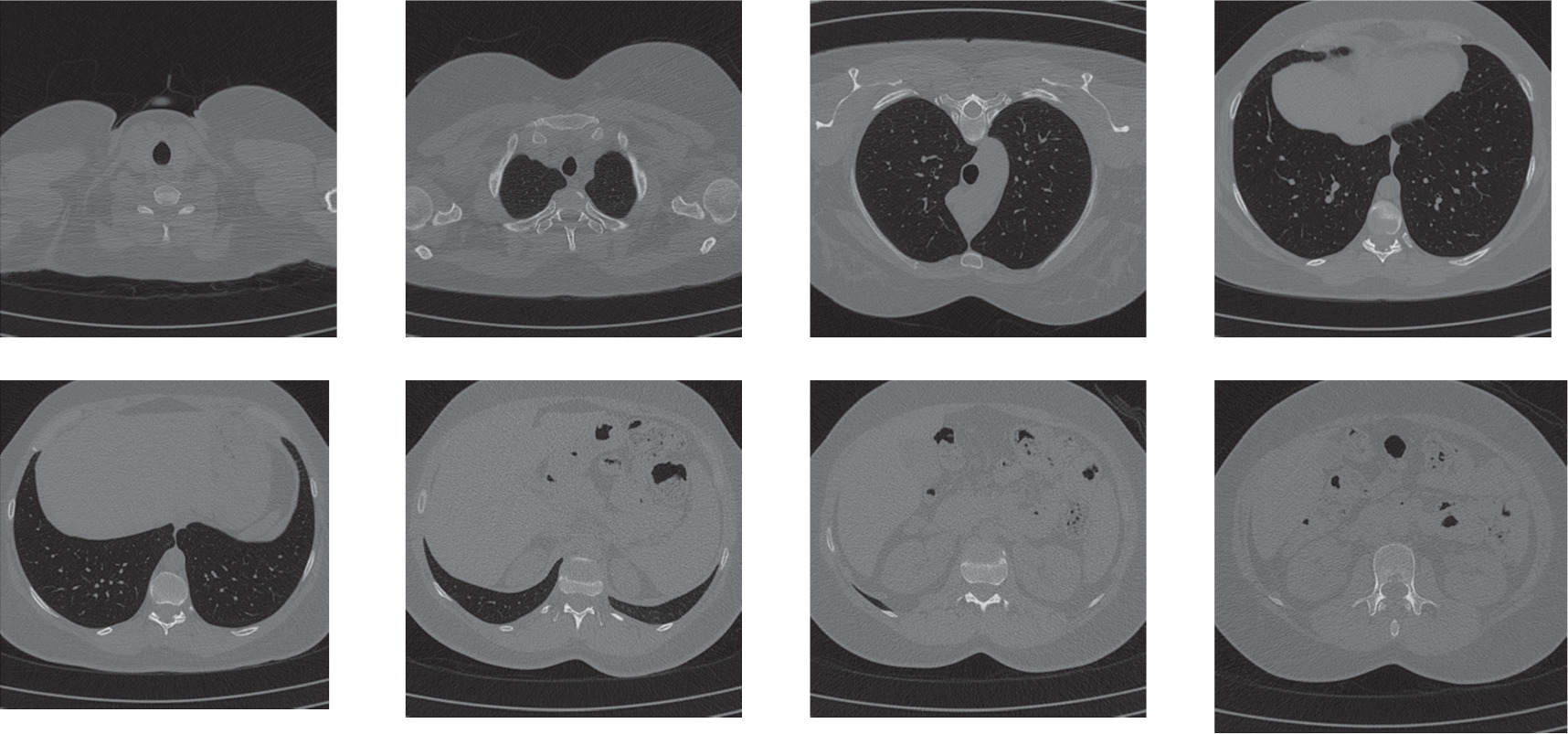Statistical similarity matching and filtering for clinical image ...