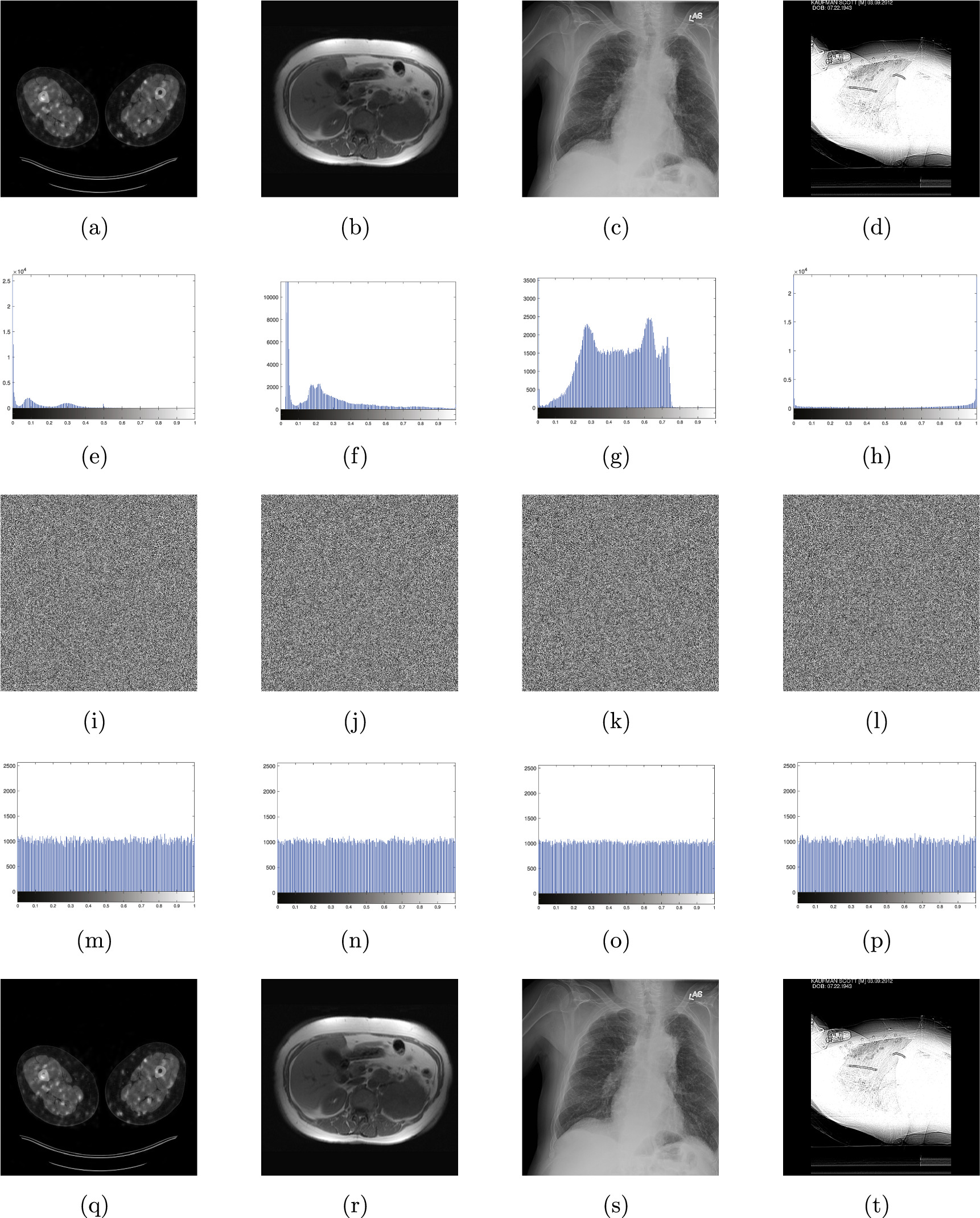 Medical image encryption system based on a simultaneous permutation and ...