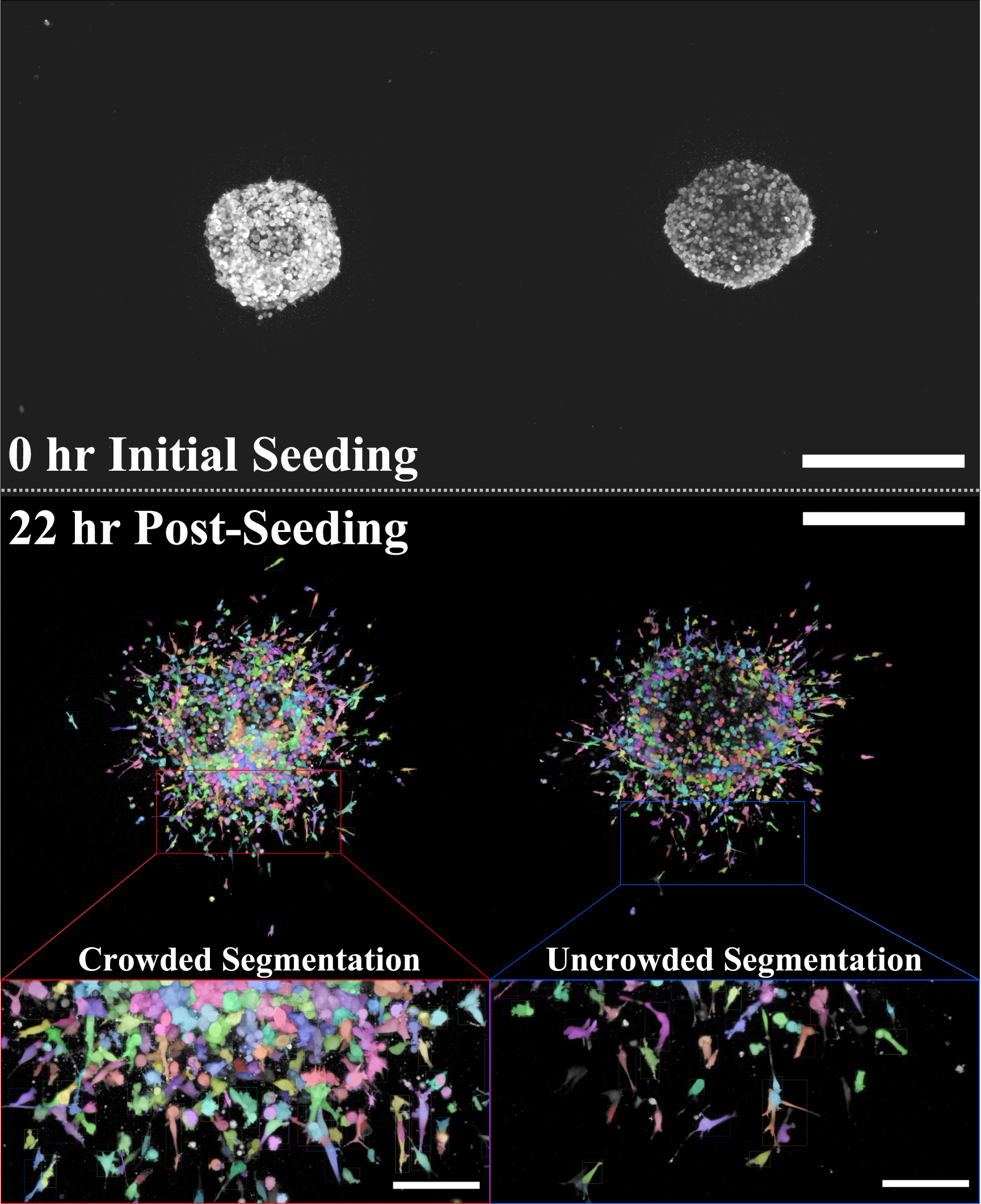 Facilitating cell segmentation with the projection-enhancement network ...