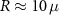 $R\approx 10\,\mu$