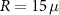 $R = 15\,\mu$