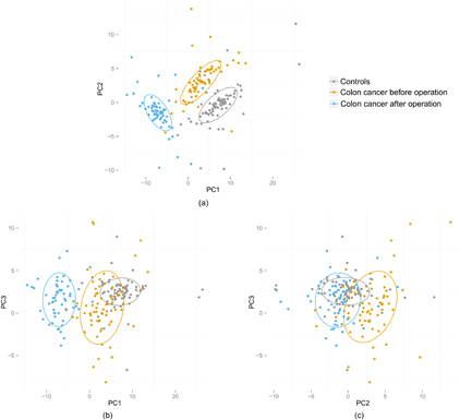 Raman spectroscopy combined with principal component analysis and k ...
