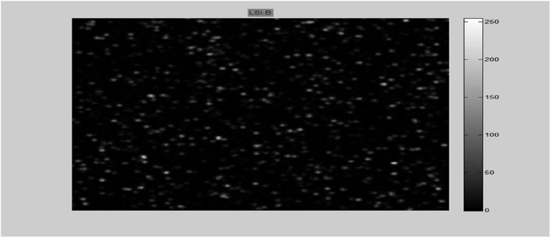 Laser speckle image velocimetry by Fast Fourier Transform technique ...