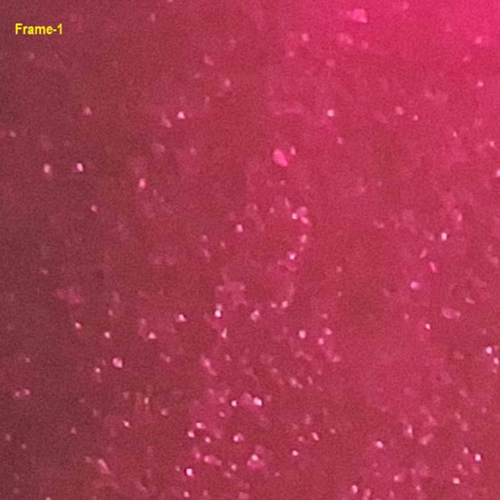 Investigation of renal calculi fragmented tracer particles in ...