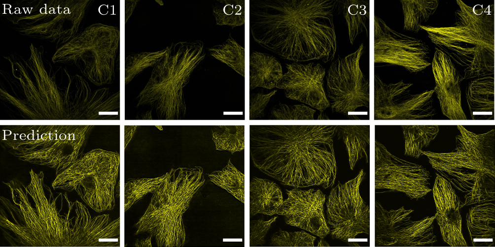 Deep learning facilitated whole live cell fast super-resolution imaging ...