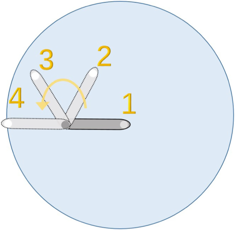 Fault Diagnosis of the LAMOST Fiber Positioner Based on a Long