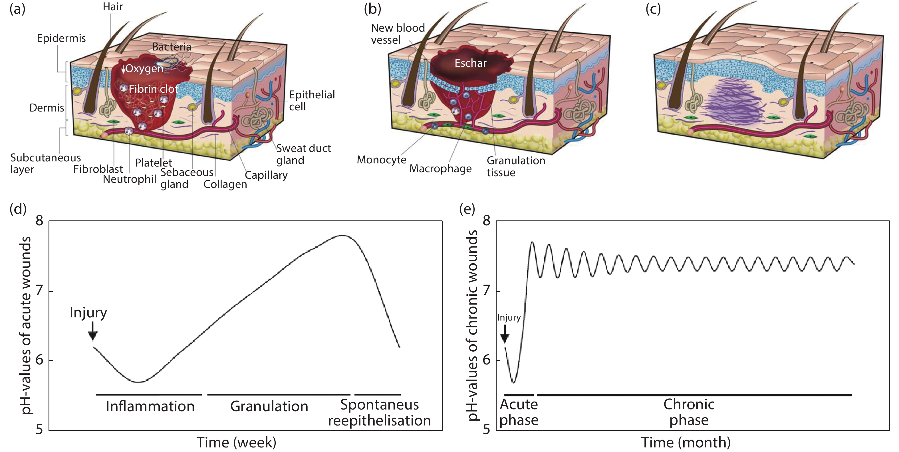 Wound Sensor Advances in flexible and wearable pH sensors for wound healing ...