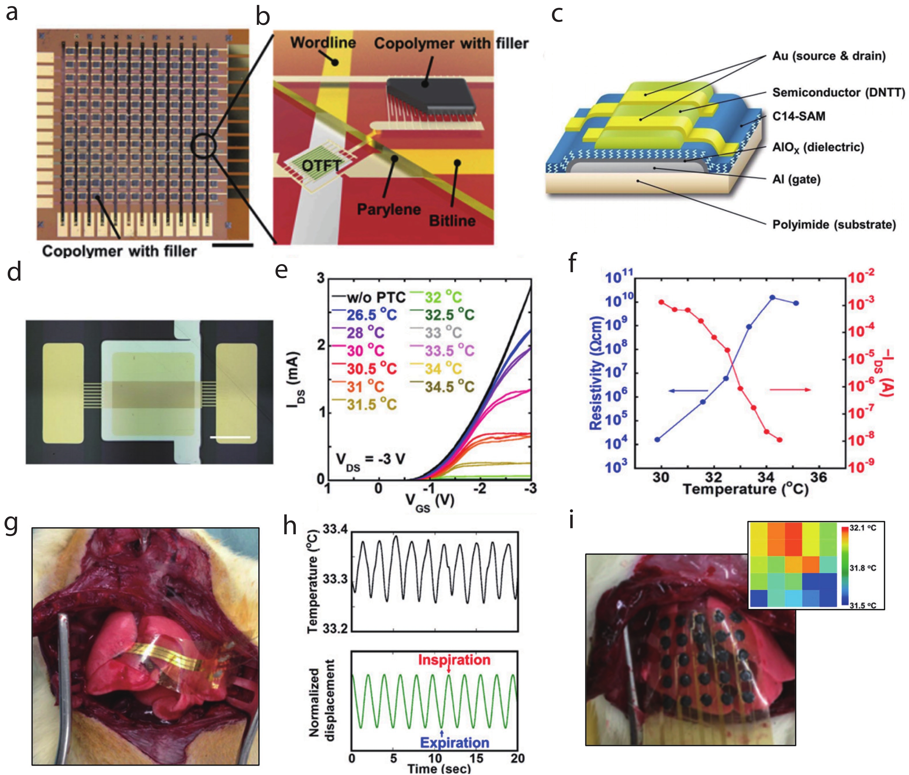 Advancements in implantable temperature sensors: Materials, mechanisms ...
