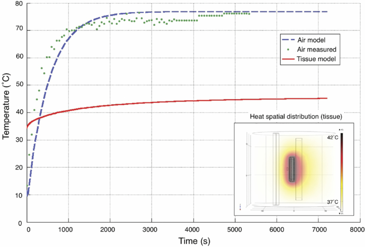 An implantable wireless neural interface for recording cortical circuit ...