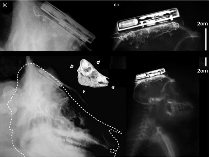 An implantable wireless neural interface for recording cortical circuit ...