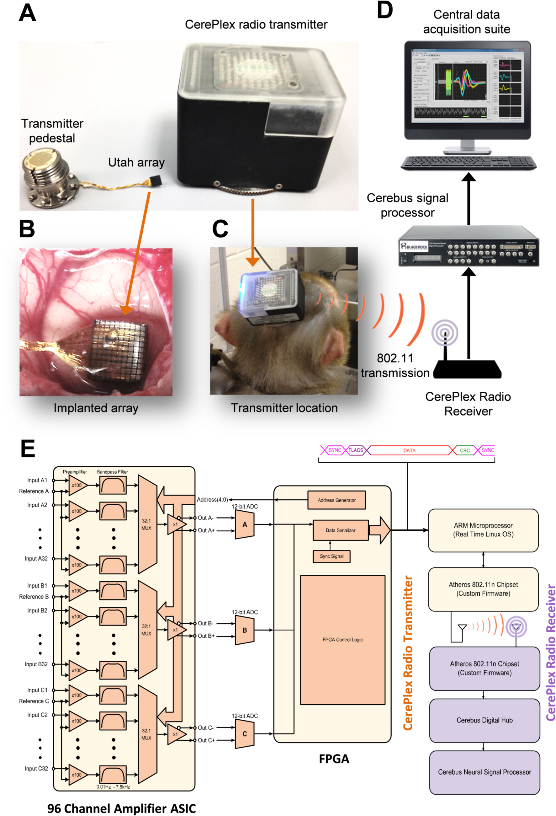A wireless transmission neural interface system for unconstrained non ...
