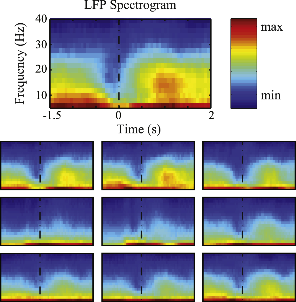 Chronic neural probe for simultaneous recording of single-unit, multi ...