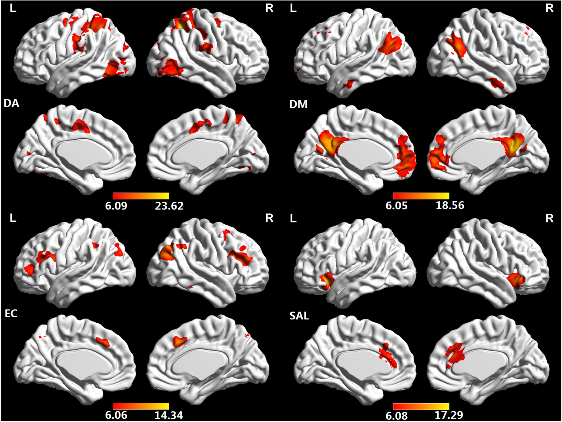 Changes of intranetwork and internetwork functional connectivity in ...