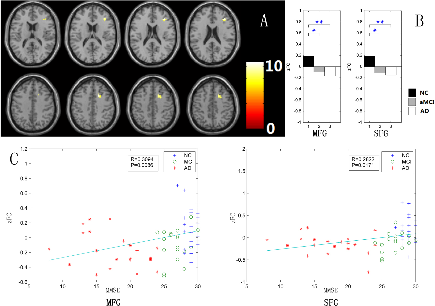 Changes of intranetwork and internetwork functional connectivity in ...