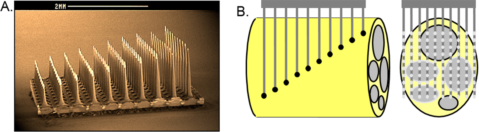 Clinical applications of penetrating neural interfaces and Utah ...