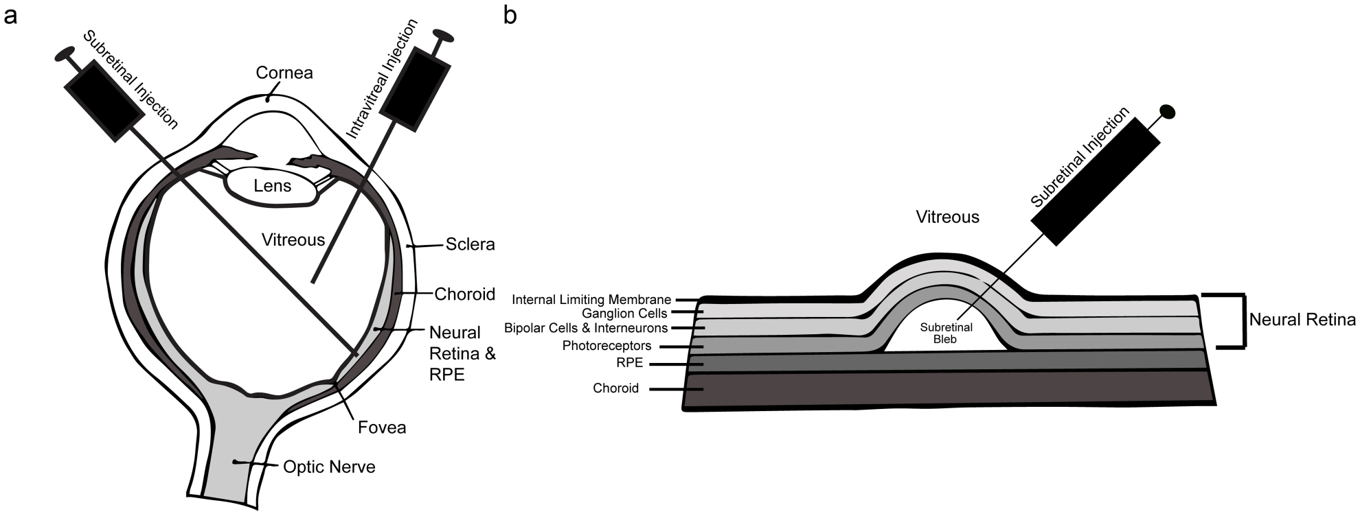Gene therapy for inherited retinal degenerations: initial successes and ...