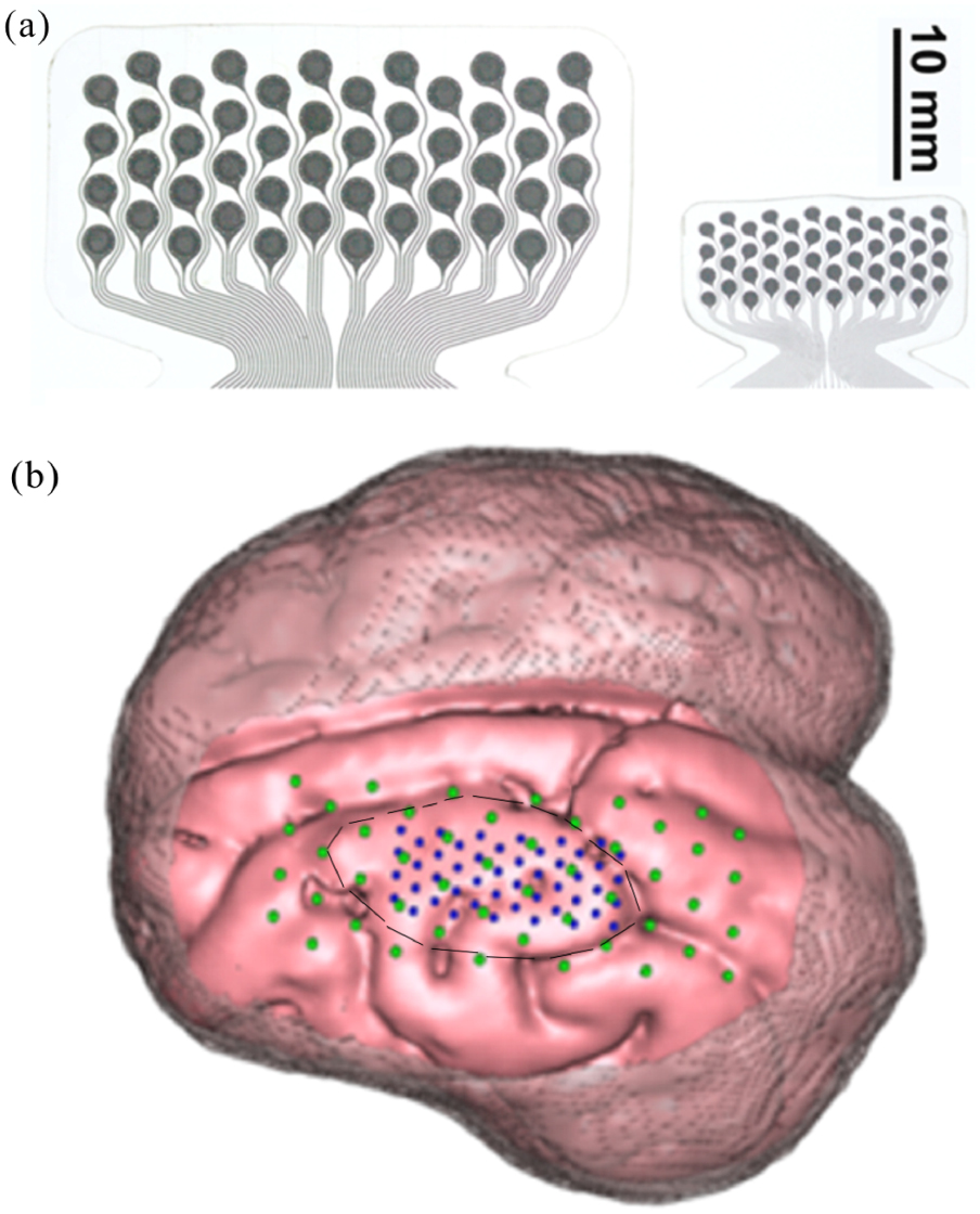 Mapping the fine structure of cortical activity with different micro ...