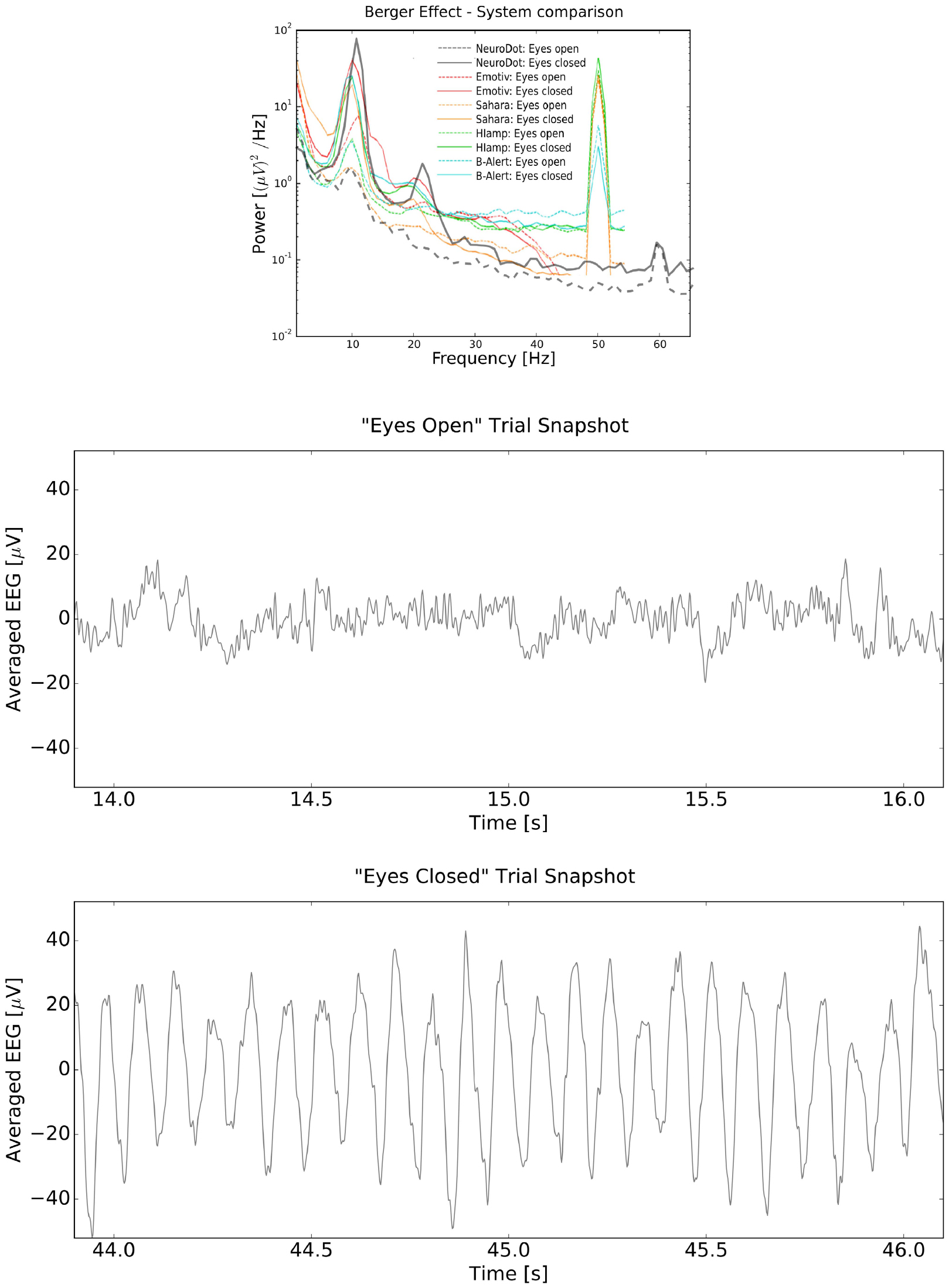 Electric field encephalography for brain activity monitoring - IOPscience
