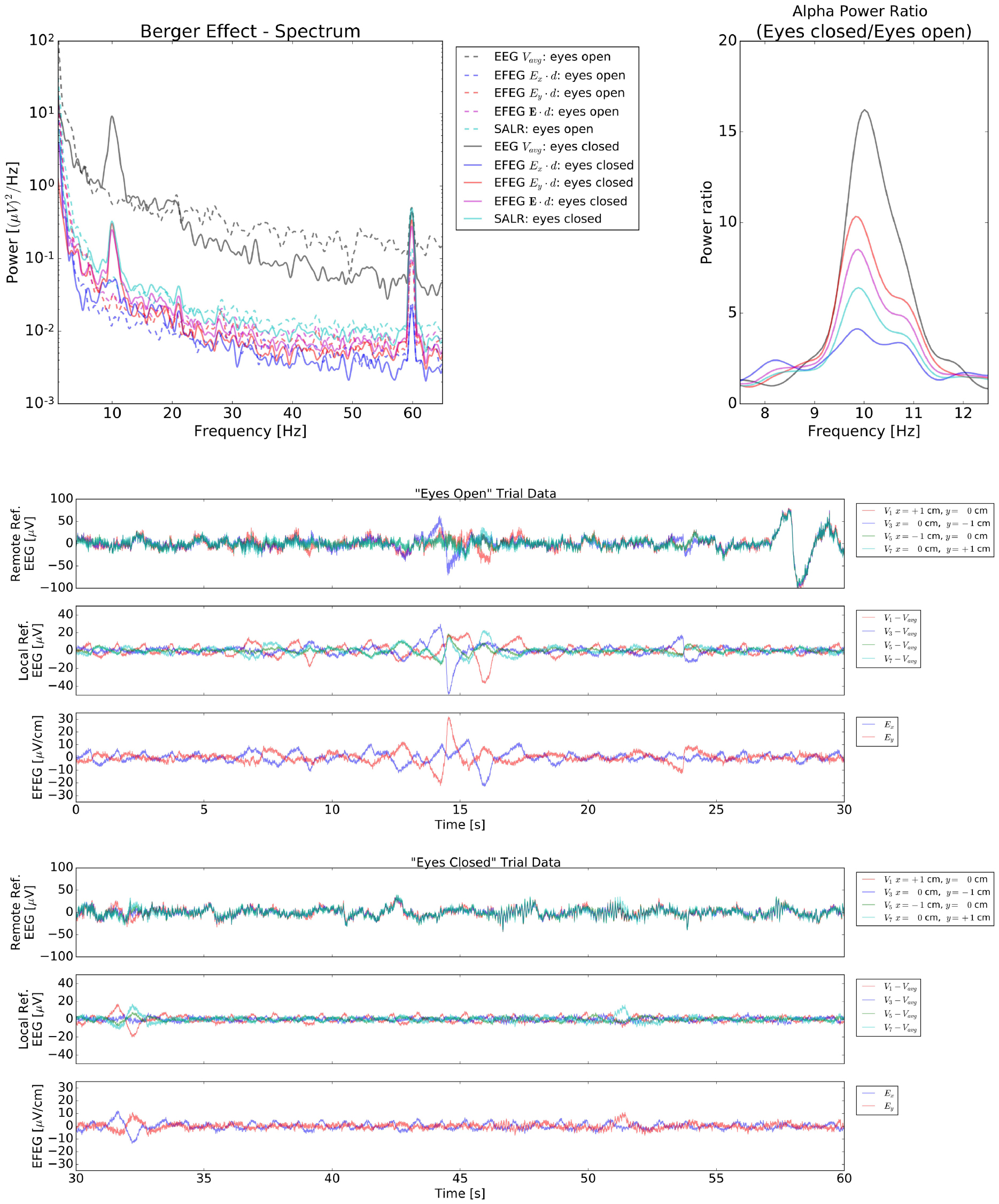 Electric field encephalography for brain activity monitoring - IOPscience