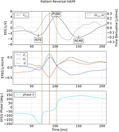 Electric field encephalography for brain activity monitoring - IOPscience
