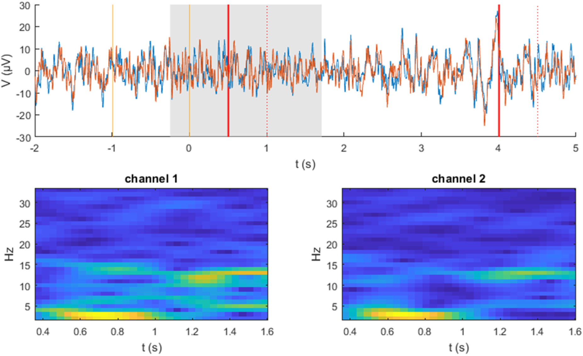 Gumpy: a Python toolbox suitable for hybrid brain–computer interfaces ...