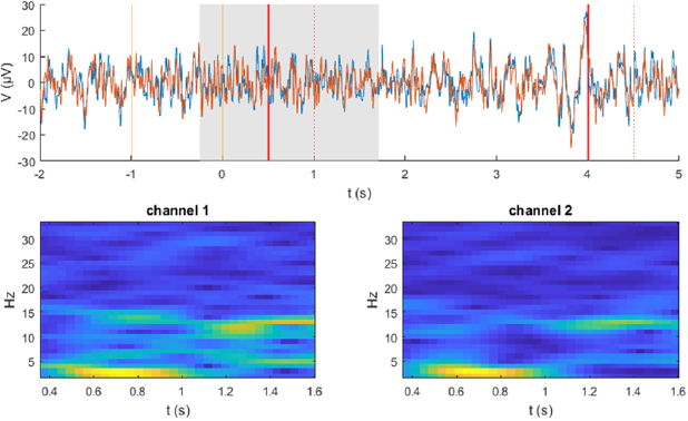 Gumpy: a Python toolbox suitable for hybrid brain–computer interfaces ...