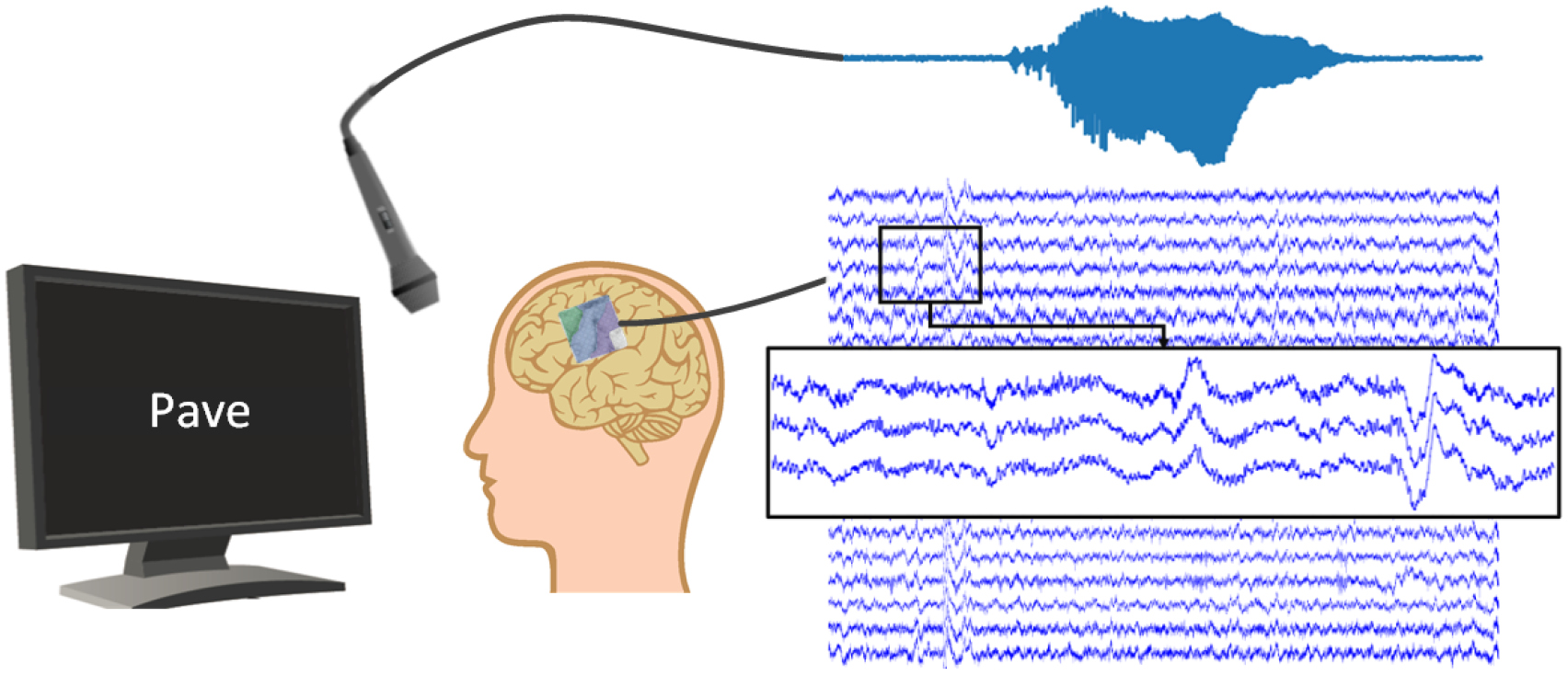 Sentence Processing Ecog Speech synthesis from ECoG using densely connected 3D convolutional ...